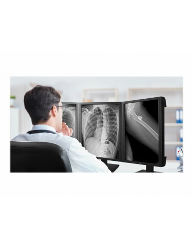 LG 21HK512D - monitor LED - 3MP -...